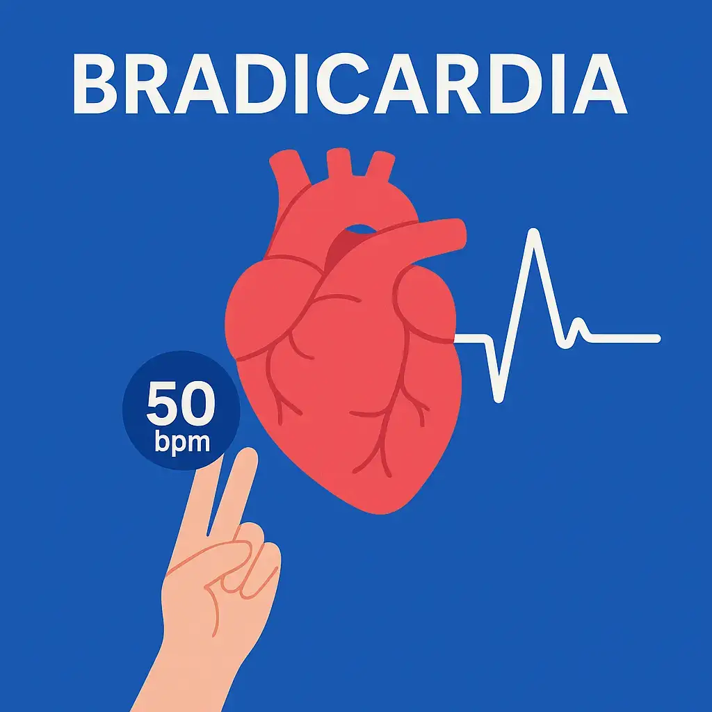 Bradiacardia sin síncope
