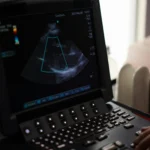 Pantalla de ecocardiograma en vista de 4 cámaras con Doppler color mostrando el flujo sanguíneo del corazón.