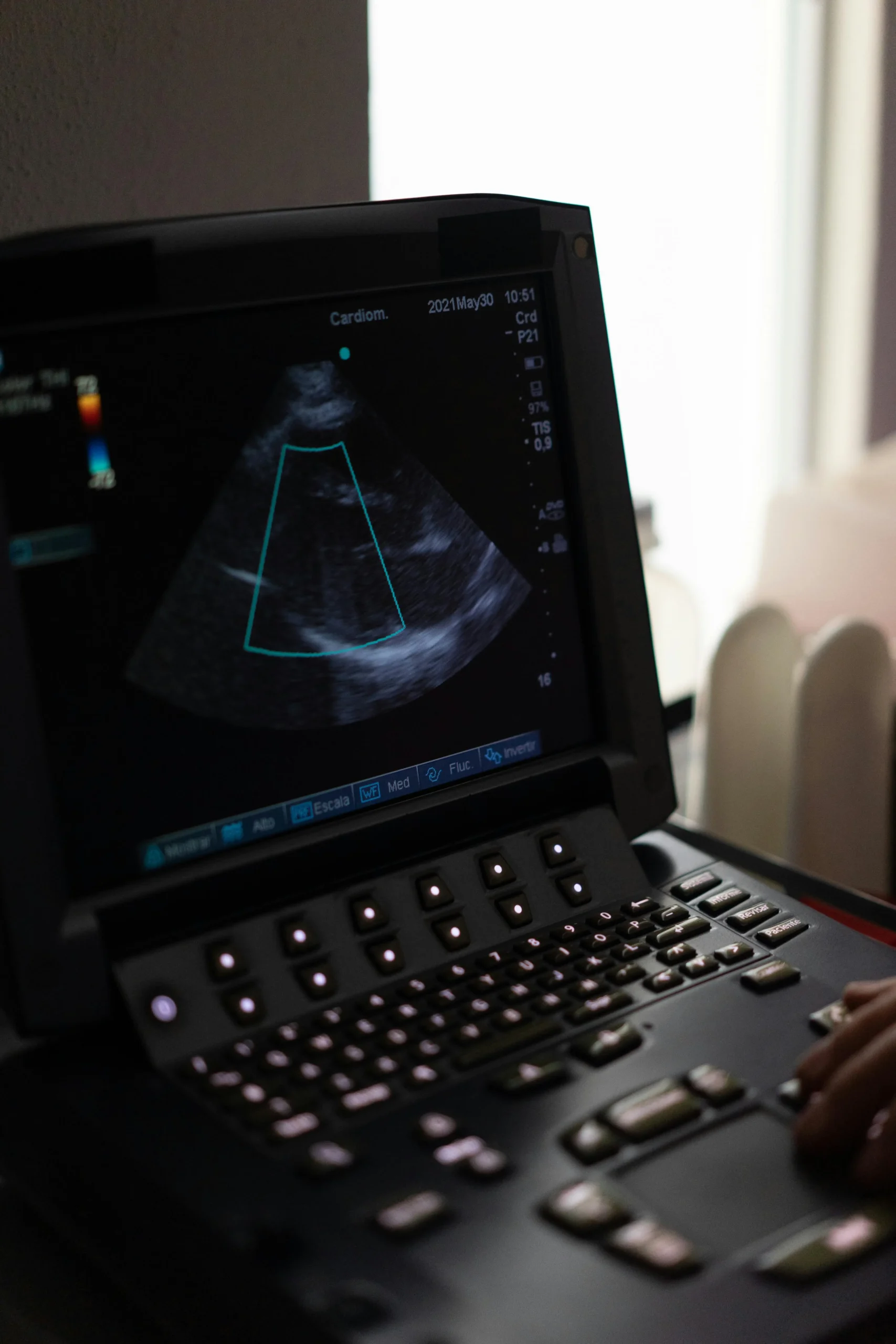 Ecocardiograma: qué es y para qué sirve